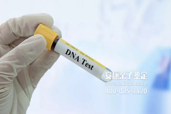 阜阳验DNA要多少钱，DNA测试要多少钱 